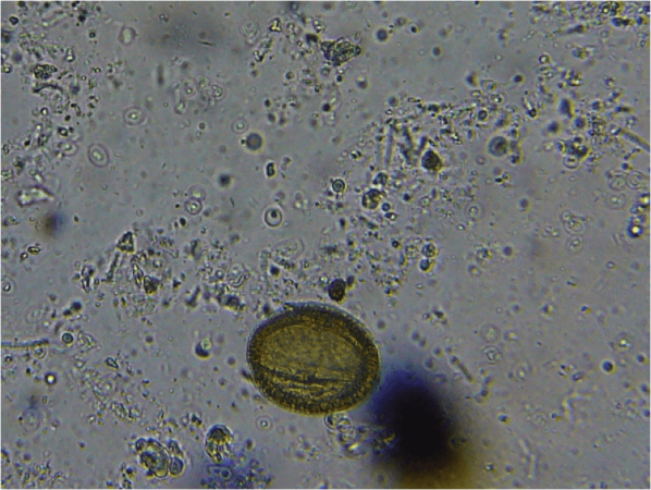 Figure 10. I included a pollen grain for scale in this photo, taken at 1000x with oil immersion. The mystery critters are the smaller oval outlines with the glowing or dark centers, which appear to be some sort of microorganism.