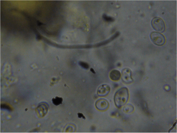Figure 11. At higher magnification, one can clearly see what appear to be organelles in the unidentified organism.